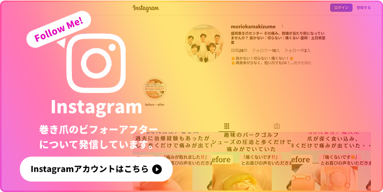 ビフォーアフターインスタグラム