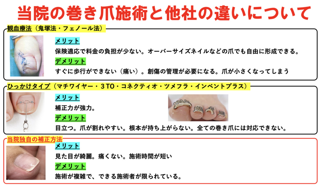 当院と外科、整形外科、形成外科、皮膚科、クリニックの手術の違い