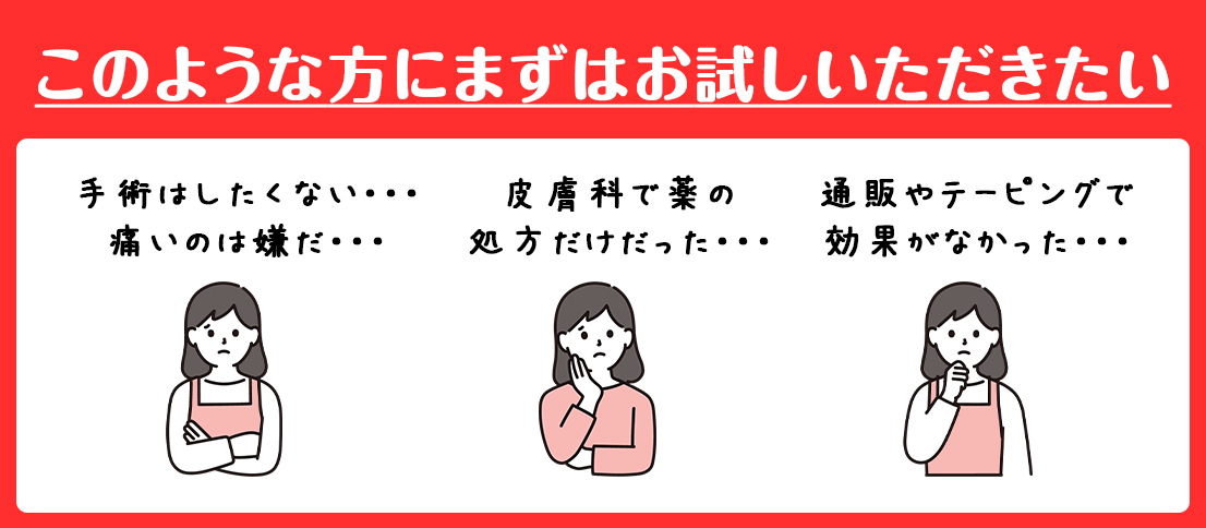 お試し